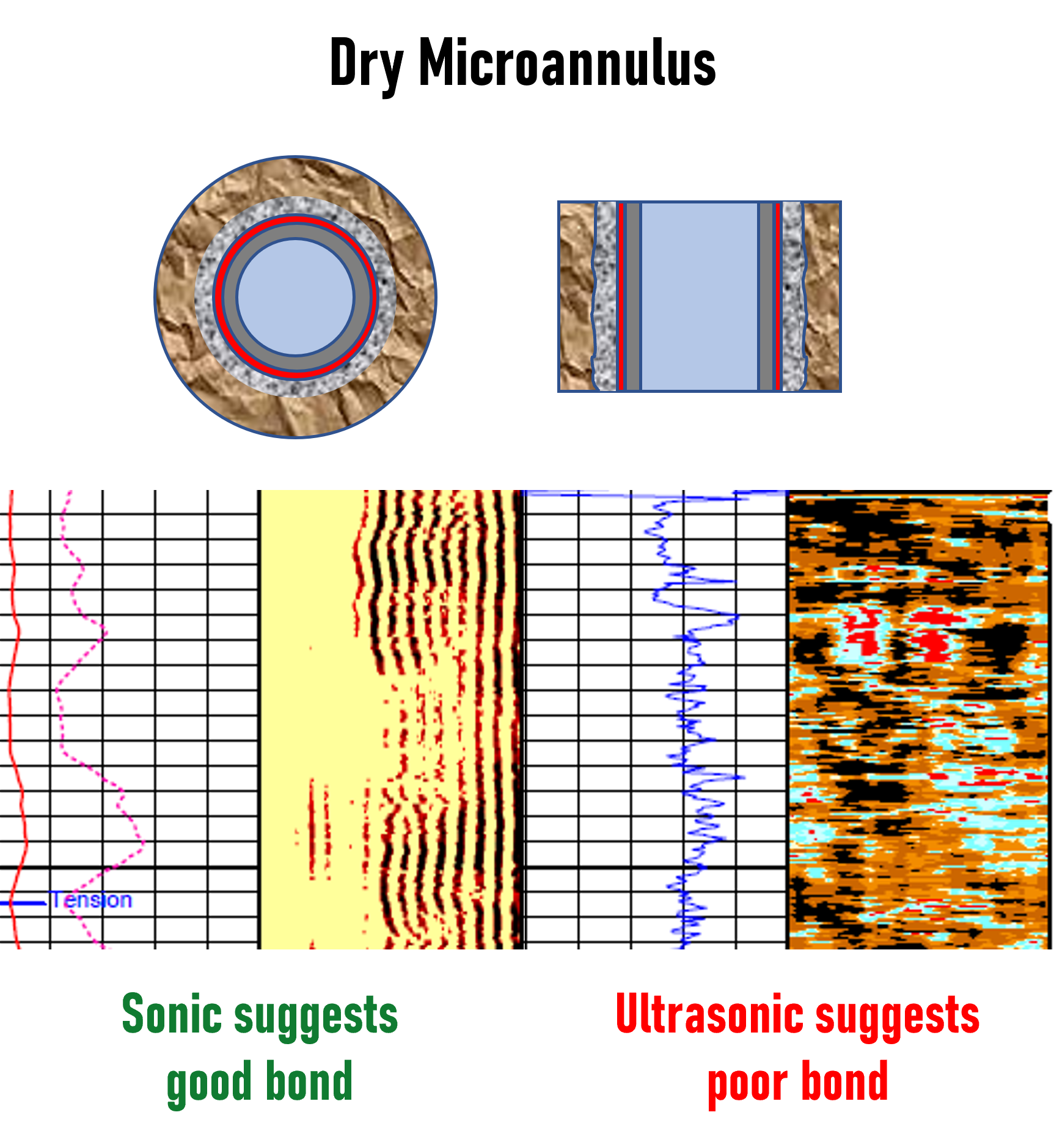 Dry microannulus example: sonic suggests good bond and ultrasonic suggests poor bond.
